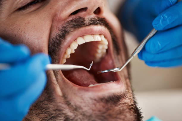 Best Emergency Dentist for Knocked-Out Tooth in Van Meter, IA