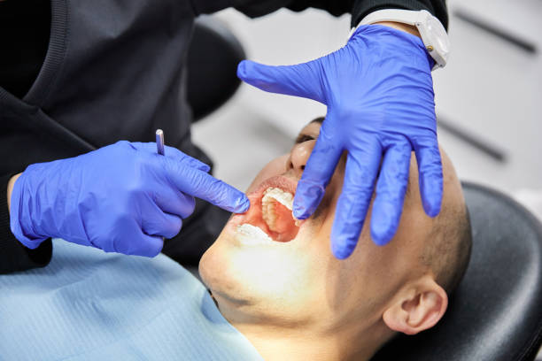 Best Emergency Root Canal Treatment in Van Meter, IA